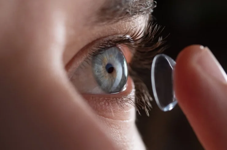 Contact Lens Fitting & Trials